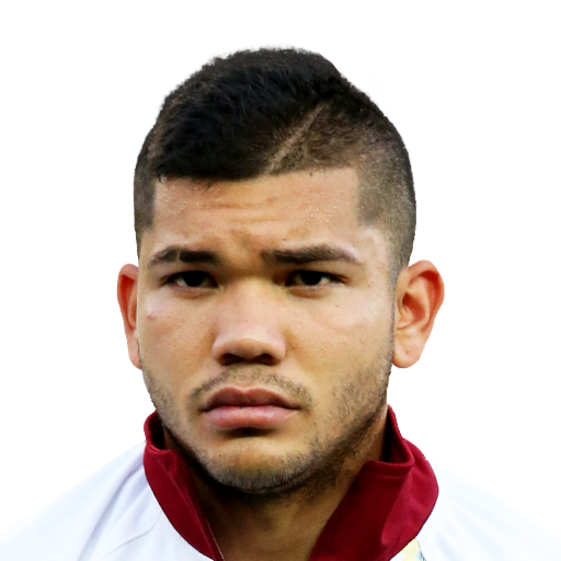 FC 25 Rommell Ibarra Face