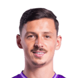 FC 26 Alexis Flips Face